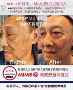 From Old and Worn to Handsome Again