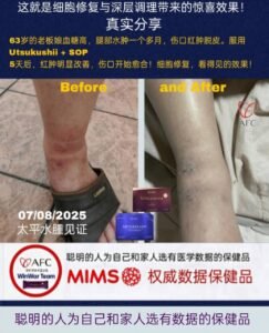 From Painful Swelling to Visible Healing in Just 5 Days