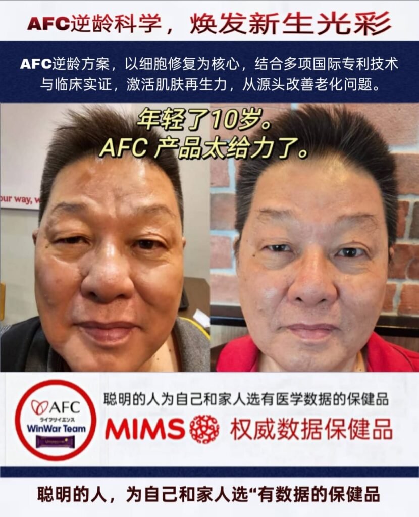 I Look 10 Years Younger! AFC Really Works!