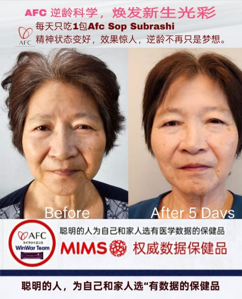 In Just 5 Days, I Saw Myself Transform