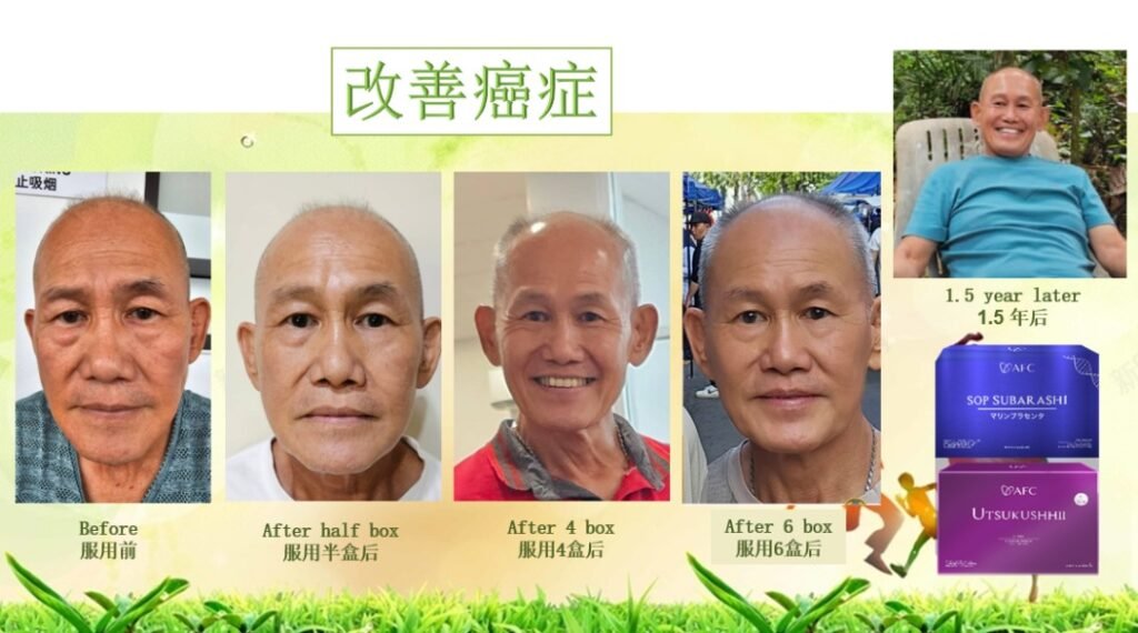 Mr. Ho’s Journey: From Cancer Struggles to New Life