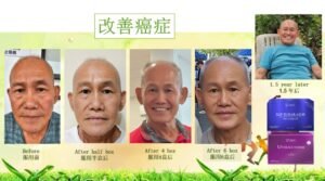 Mr. Ho’s Journey: From Cancer Struggles to New Life